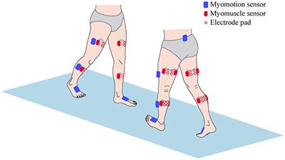 Evaluation of Multilevel Surgeries in Children With Spastic Cerebral Palsy Based on Surface Electromyography